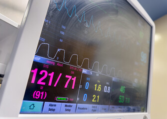 Hospital monitor symbolizes vital signs: heart rate, blood pressure, oxygen levels, temperature, ensuring patient well-being and medical care