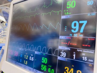 Hospital monitor symbolizes vital signs: heart rate, blood pressure, oxygen levels, temperature,...