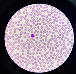 Lymphocyt WBC on red blood cell background.