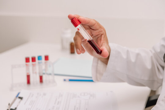 Senior man with tube of blood writing result of test