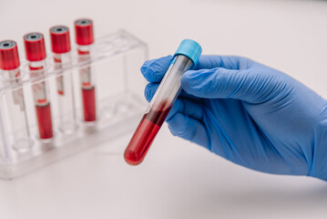 Crop doctor holding blood test tube in lab