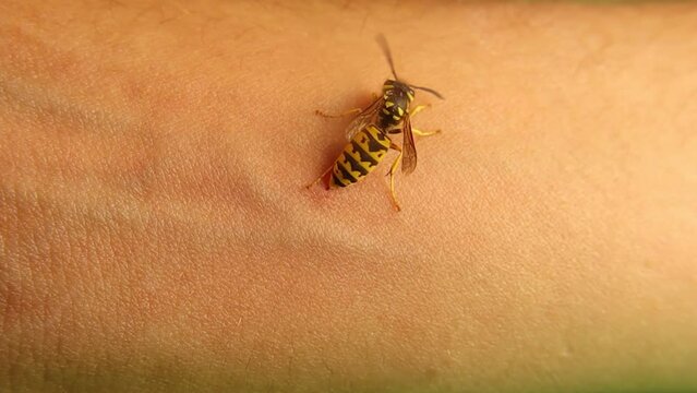 Exotic vet gets his arm stung by a yellow wasp. This sting was very painful. It's  noted that the wasp was able to withdraw its stinger without being harmed itself. German yellowjacket, Yellow hornet