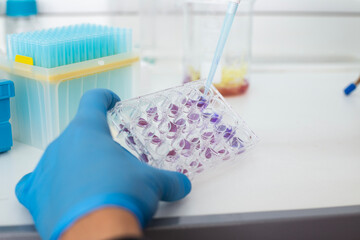 biology medicine and medical laboratory photo and cell culturing multi well plate and pipette safety cabinet