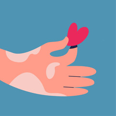 The hand holds a heart on which is problematic skin from vitiligo syndrome on a blue background. World Vitiligo Day. Flat illustration of helping people with problem skin. Skin diseases.