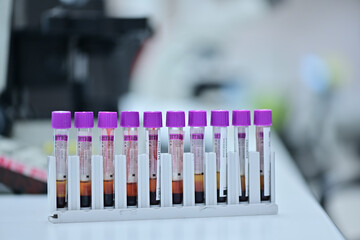 Medical technologist using diagnostic equipment in a cancer hospital lab in Asia