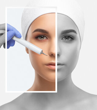 The doctor-cosmetologist makes the procedure treatment of Couperose of the facial skin of a beautiful, young woman in a beauty salon.Cosmetology and professional skin care.