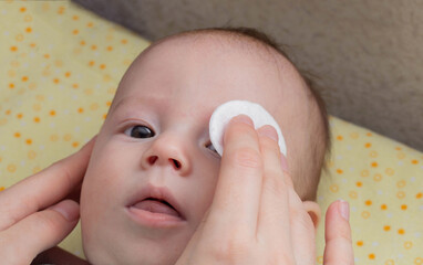 The mother washes the child's eyes with a cotton pad. Eye care and hygiene for newborns.