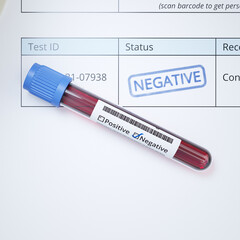 Negative test of a blood sample. Viral infection. Patient documents. Laboratory