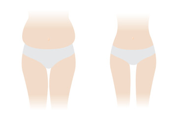 Comparison of woman body fat and slim vector isolated on white background. The woman with fat belly, hip, thigh and slender body. Slim waist compared to body fat. Before and after weight loss.