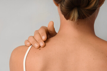 Young woman with moles on light background, back view