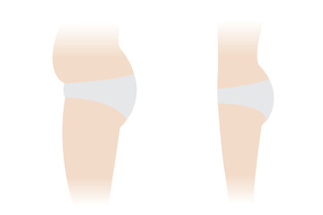 Side view of woman body fat and slim vector illustration isolated on white background. Comparison of woman with fat belly, hip, thigh and slender body. Before and after weight loss.