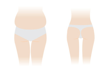 Back view of woman body fat and slim vector illustration isolated on white background. Comparison of woman with fat buttocks, hip, thigh and slender body. Before and after weight loss.