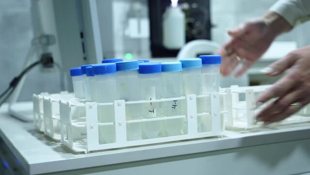 A female lab technician carries test tubes for analysis. Science research center.