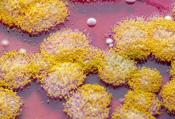 Macro view of fungal colonies from a soil sample growing in a petri dish with rose bengal agar...