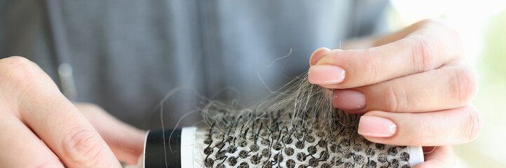 Woman hands holding comb full of hair