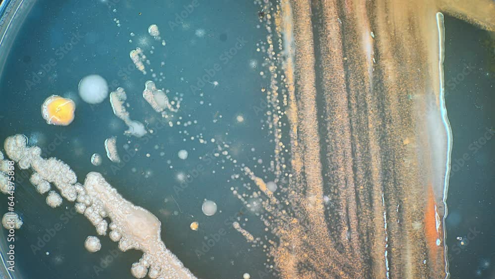 Wall mural growth of a colony of microorganisms on the surface of agar in a Petri dish study of the microbiome of natural water bodies