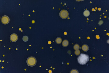 Obraz na płótnie Canvas 寒天培地に生育した細菌のコロニー