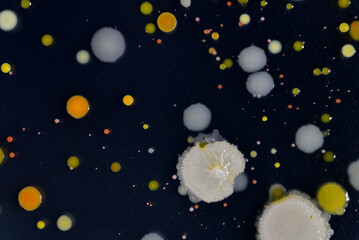 寒天培地に生育した細菌のコロニー