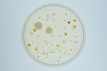 寒天培地に生育した細菌のコロニー