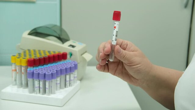 A nurse puts a barcode on a blood test tube.