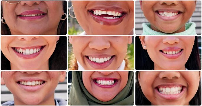 Smile, collage and closeup of mouth of women in city for happiness, joy and facial expression. Dental care, oral hygiene and zoom of happy people for teeth whitening for confidence, pride and health
