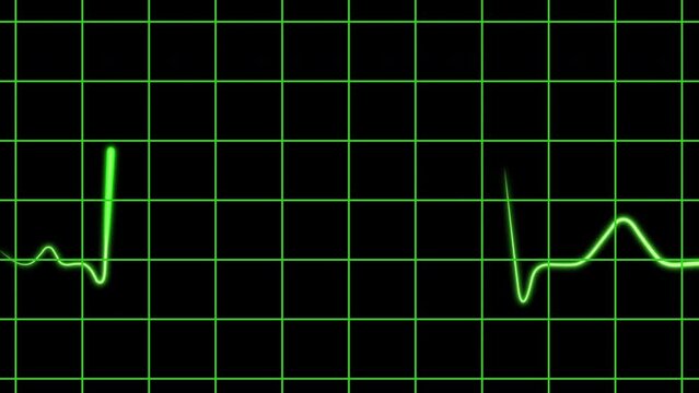 Heart pulse in green color on a monitor screen with a grid on a black background.