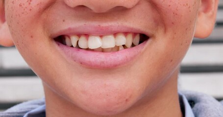 Smile, happy and closeup of mouth of boy in city for happiness, joy and facial expression. Dental care, freckles and face zoom of child for teeth whitening for confidence, pride and oral health