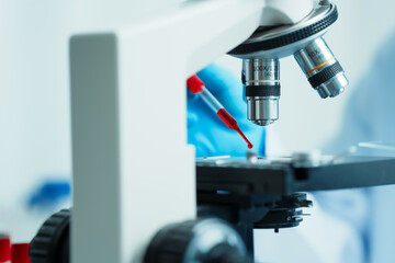 Close up dedicated hematology lab technician scrutinizing blood sample analysis under microscope,...