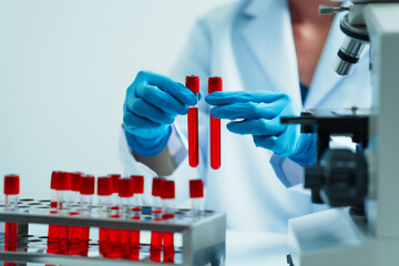 Close up dedicated hematology lab technician scrutinizing blood sample analysis under microscope,...