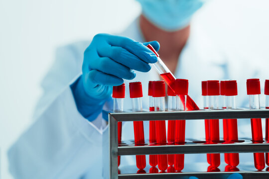 Close up dedicated hematology lab technician scrutinizing blood sample analysis under microscope, scientific laboratory research and drug testing concept, red color liquid
