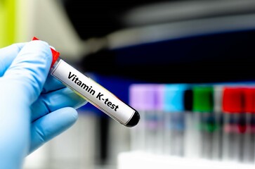 Fototapeta premium Blood sampling tube for vitamin K analysis.