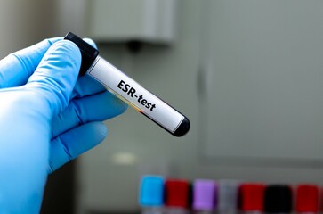 Blood sampling tube for ESR analysis.