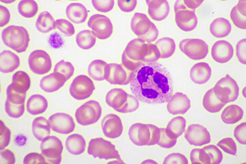 White blood cell in blood smear, analyze by microscope, original magnification 1000x