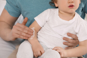 Father applying ointment onto his son`s arm, closeup