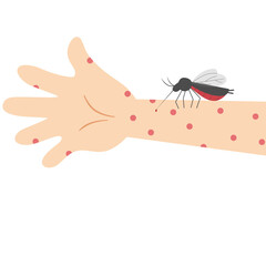 malaria mosquito bite hand