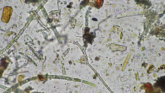 diatom and water microorganisms under the microscope