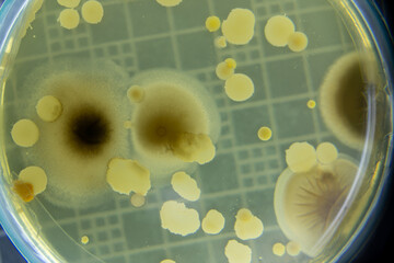 Backgrounds of Characteristics  of Bacteria and Fungi  for education in Microbiology laboratory.