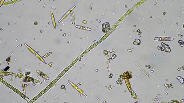 diatom and water microorganisms under the microscope