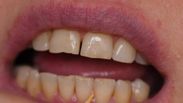 close-up of a female mouth, a woman picks her teeth with a toothpick removing leftover food.selective focus.oral hygiene with a toothpick wooden