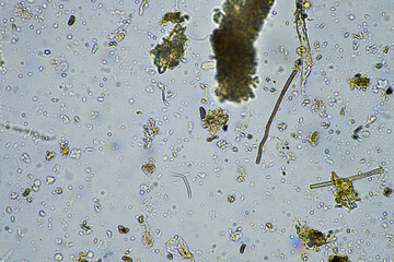 Fungal and fungi hyphae under the microscope in the soil and compost, in a soil biology and...