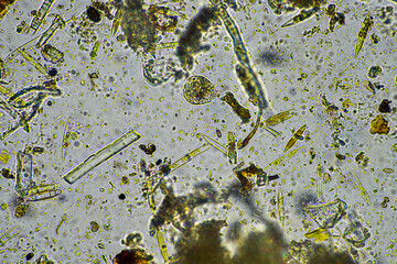 diatom and water microorganisms under the microscope