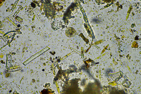 diatom and water microorganisms under the microscope