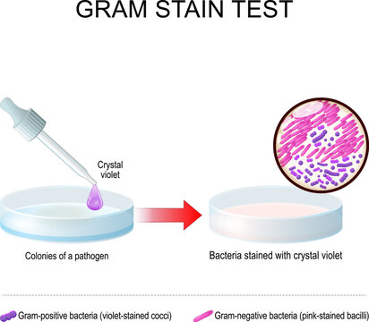 Gram stain test. A glass Petri dish with pathogen bacterial culture
