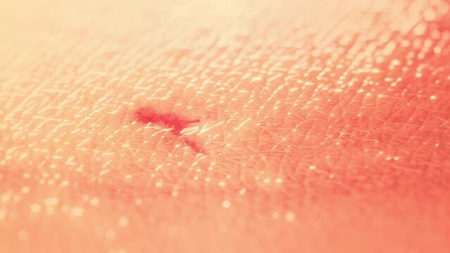 Skin Scar Regeneration. 3D Render - The wound with blood heals and completely disappears, leaving only a healthy skin texture.