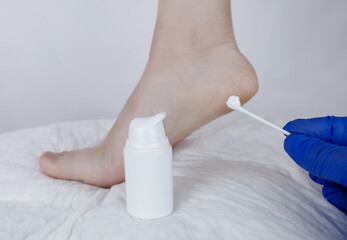 Cracked heels. Woman feet before and after procedures to soften rough skin. Urea cream, oil for care of keratinized skin, healing of cracked foot. Usage foot grater, cream with urea, softening oil.