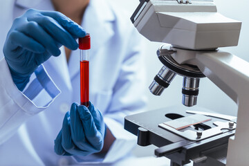 Hands of a doctor or female doctor collecting blood sample tubes from rack with analyzer in lab. Doctor holding blood test tube in research laboratory red blood cells