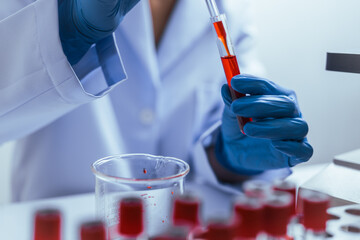 Hands of a doctor or female doctor collecting blood sample tubes from rack with analyzer in lab. Doctor holding blood test tube in research laboratory red blood cells