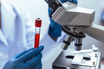 Hands of a doctor or female doctor collecting blood sample tubes from rack with analyzer in lab. Doctor holding blood test tube in research laboratory red blood cells