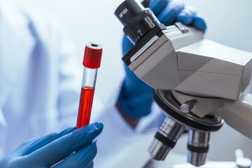 Hands of a doctor or female doctor collecting blood sample tubes from rack with analyzer in lab. Doctor holding blood test tube in research laboratory red blood cells