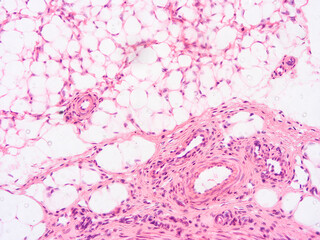 histology human tissue with microscope from laboratory (not Illustration Designation)